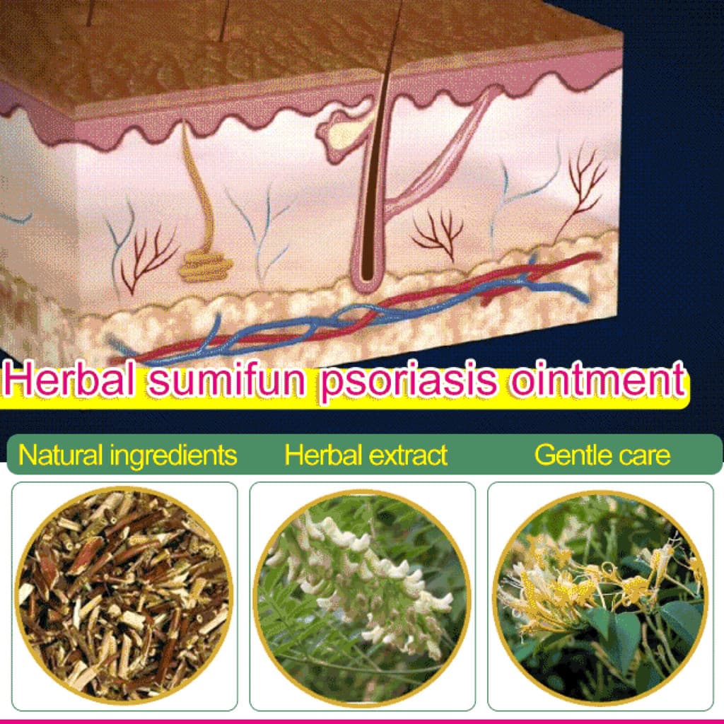 【Para Todos Tipos de Pele】Recommended Sumifun Psoriasis Ointment Psoríase/Hidratante/Tratamento/Coceira