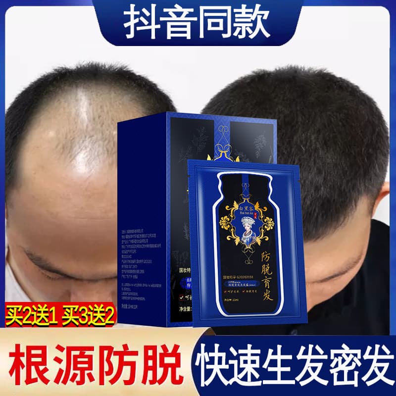 Branco Hacking Hakka Anti-queda de cabelo densidade shampoo de crescimento do cabelo densidade óleo do cabelo transborda