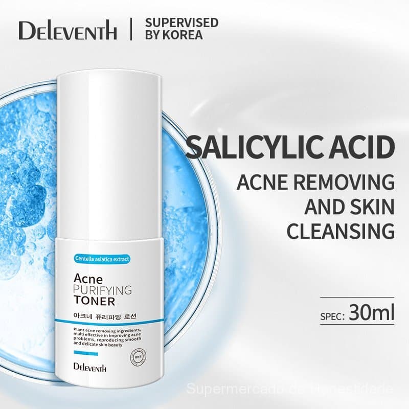 Tônico para Tratamento de Acne com Ácido Salicílico Controla a Oleosidade, Hidrata, Reduz Marcas de Acne e Melhora a Pel