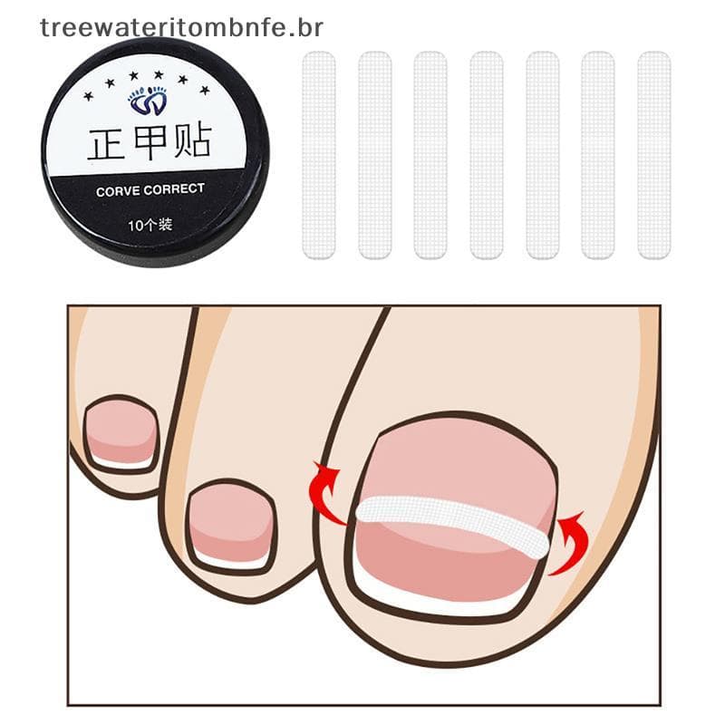 10 Pçs Tratamento De Unhas Encravadas Ferramenta De Correção Remendo Elástico Stier Alisamento Clipe Cinta Ferramentas D