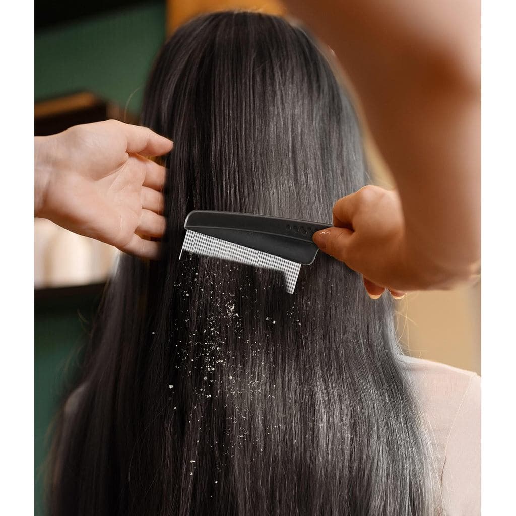 Dandruff Comb Fine Tooth Scalp Detox Comb Lice for Women, Men & Kids Stainless Steel Scalp Detoxing, Sweep & Massage Hai