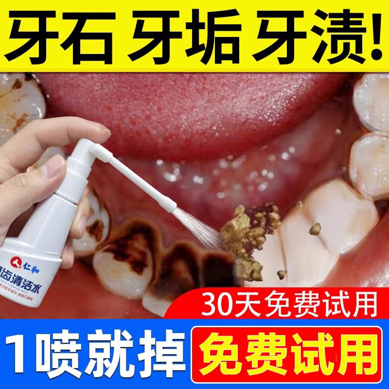 Removedor de cálculo Dental dissolver remoção de tártaro não de ação rápida enxaguatório bucal lavagem de água dentes su