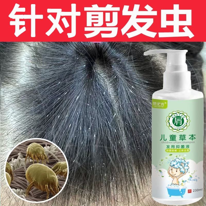 Corte de cabelo inseto shampoo menina remover insetos de cabelo remover pontos brancos no cabelo anti-caspa anti-coceira