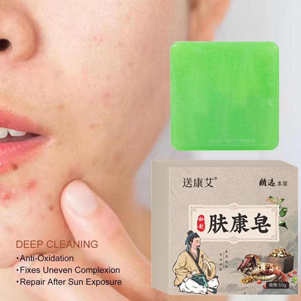 Sabonete De Banho 50g Remove Manchas De Odor/Acne/Suor , Adequado Para Idosos E Odores Corporais . Pode Ser Usado No Ros