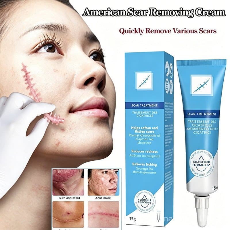 Creme para Remoção de Cicatrizes - Adequado para Restaurar a Pele, Suavizar e Eliminar Acne 15g QWYV