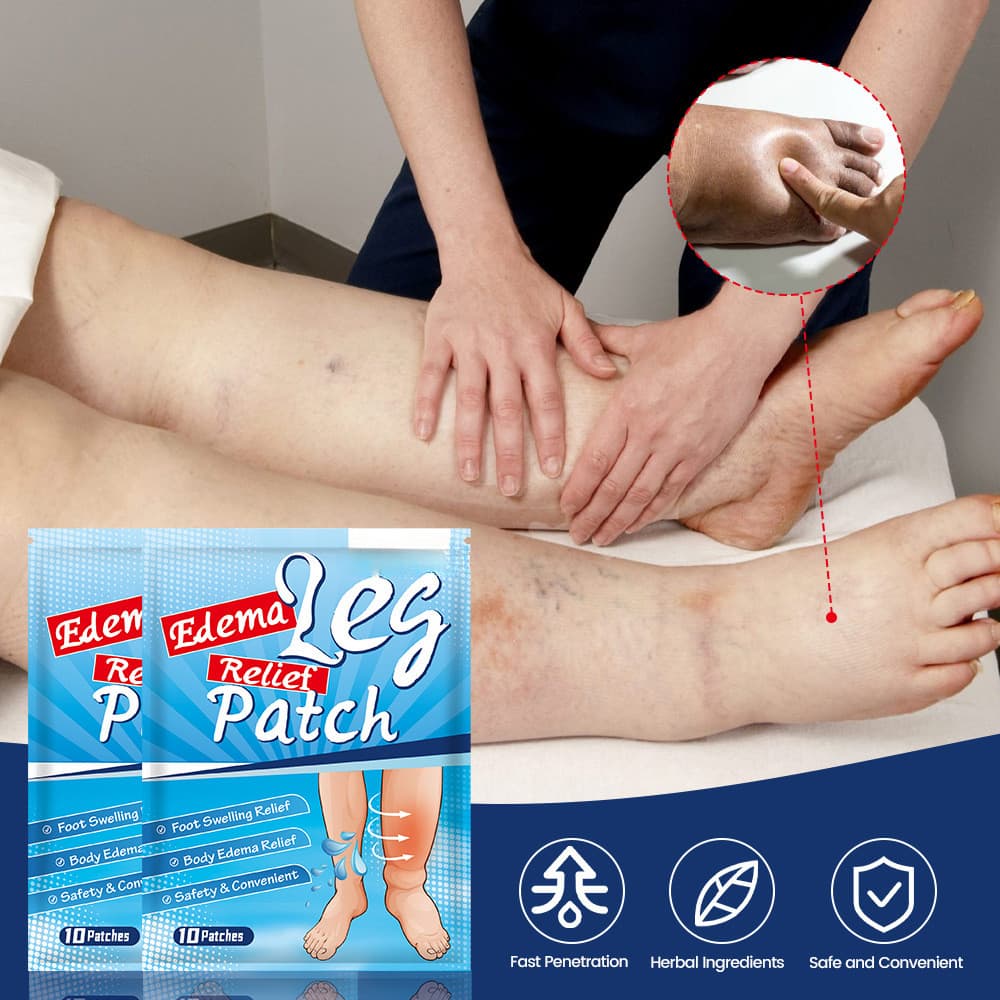 10 Unidades/1 Pacote de Adesivo para Alívio de Edema para Inchaço nas Pernas, Cuidados com os Pés, Alívio da Coceira, Va