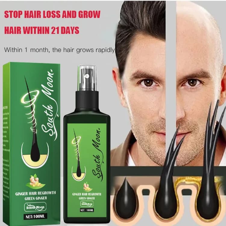 【Prevenção de Queda】7days Ginger Hair Regrowth/Spray Capilar/Cuidado para Couro Cabeludo/Crescimento de Cabelo