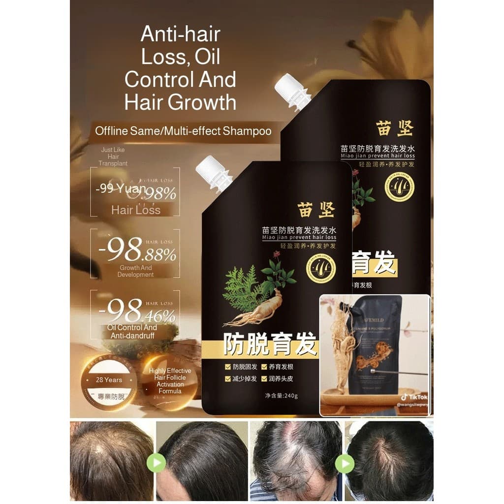 [Natural E Seguro] HFH- Shampoo Antiqueda/ Ginseng/ Crescimento Saudável/ Para Homens E Mulheres