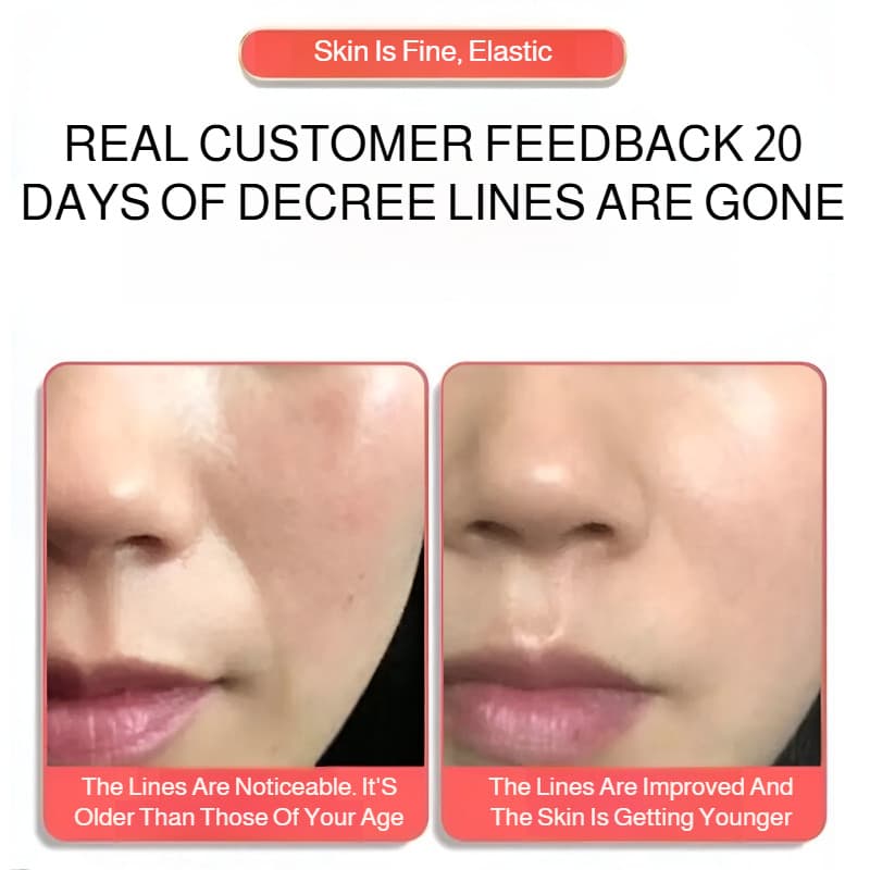 【Efeito Pluma】Linhas especiais para dormir, adesivo antirrugas com efeito pluma/Antirrugas/Adesivo/Facial