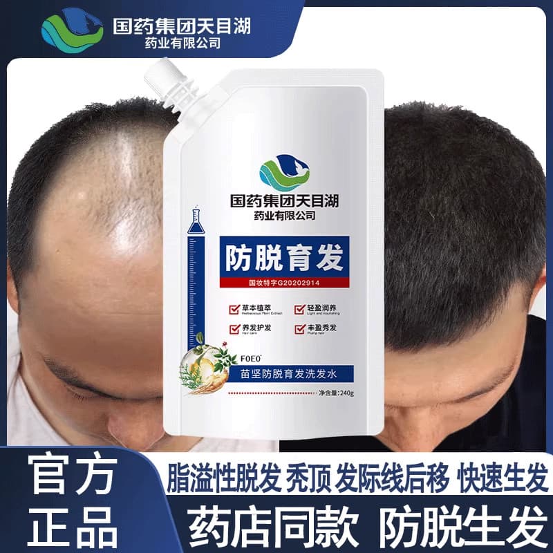 Shangguan borda anti-perda de cabelo anti-perda de cabelo Shampoo transbordamento de gordura perda de cabelo cabelo fort