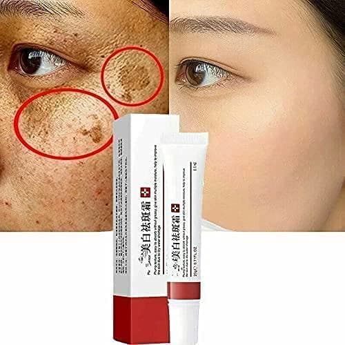 Creme para manchas escuras faciais, creme para remoção de manchas faciais