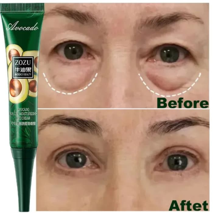 Cuidados com os olhos eliminar olheiras creme para os olhos instantaneamente rugas suaves eliminam inchaço flutuante dos