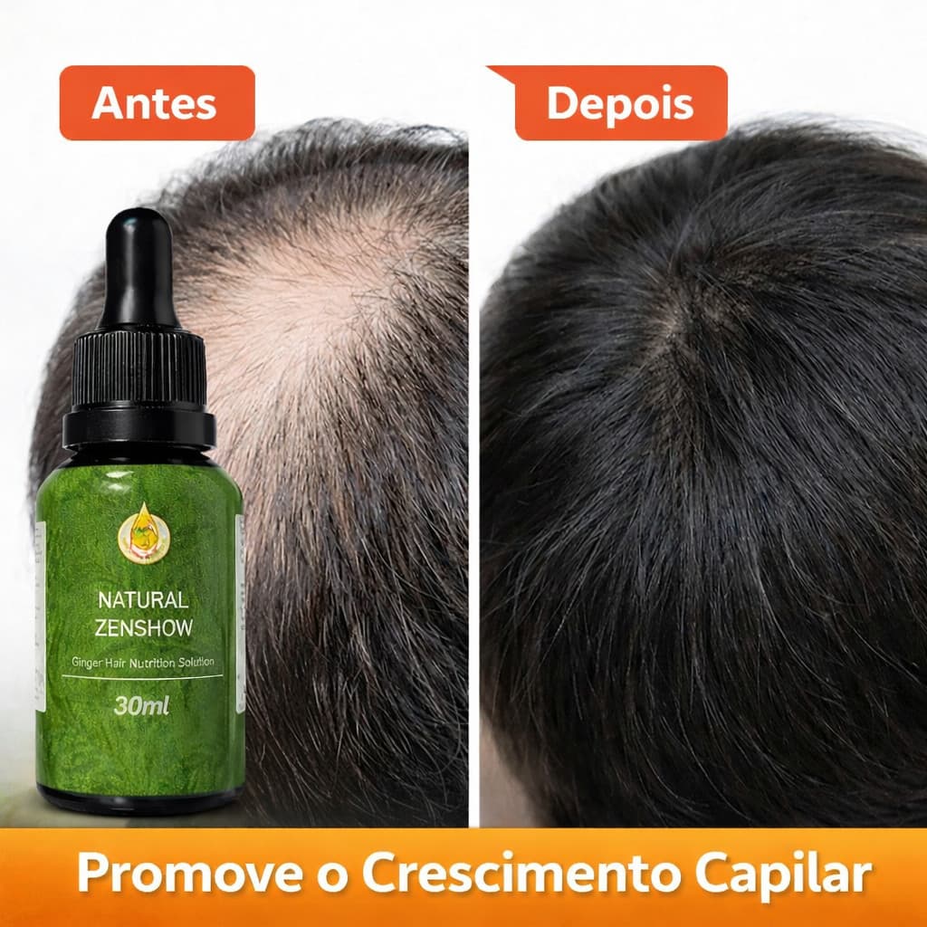 Óleo Essencial ZenShow Para Crescimento de Cabelos Capilar Tração Louco Gengibre Selvagem Prevenir Alopecia 30ml