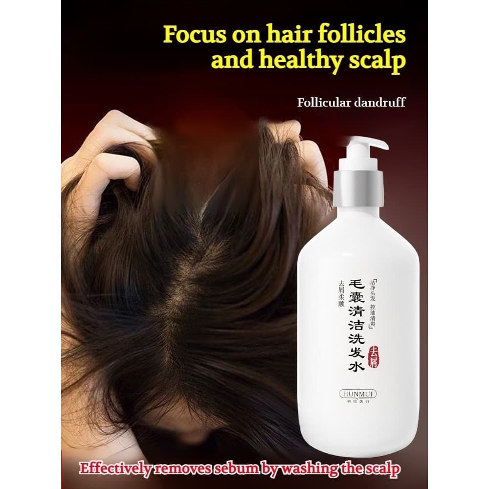 【Frescura Prolongada】Anti-Dandruff Shampoo/Oil Control/Itchy Scalp Relief Shampoo/Para Couro Cabeludo Sensível