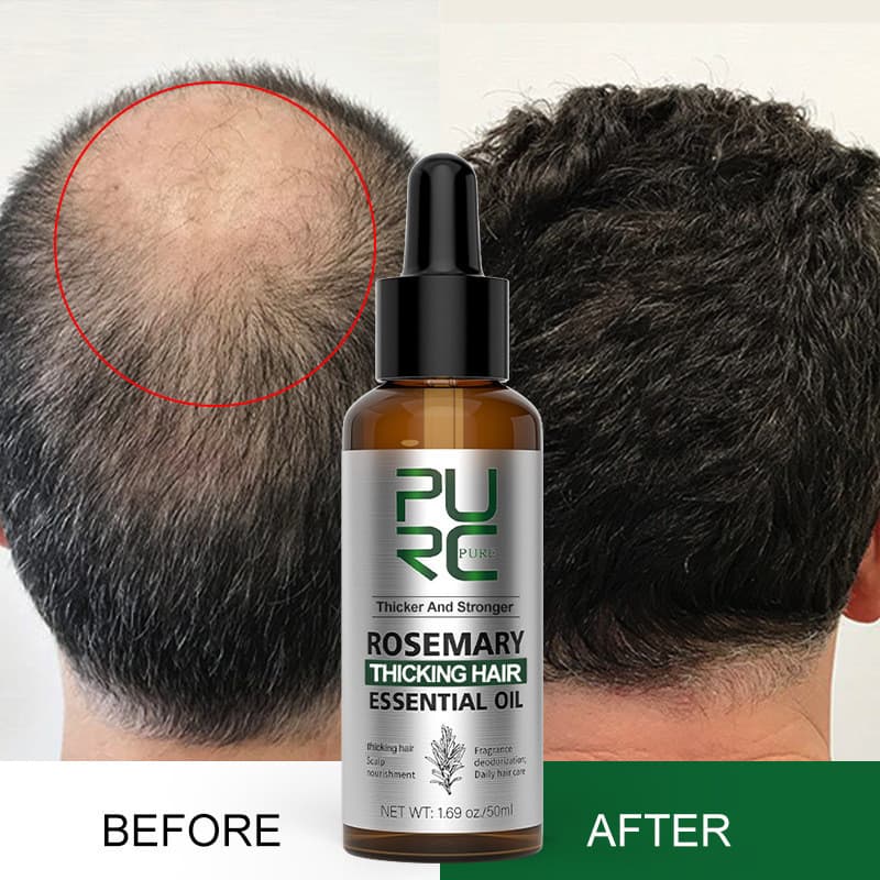 Óleo Essencial de Alecrim para Cuidado Capilar, Óleo Essencial de Menta e Gengibre para Cuidado Capilar e Nutrição do Co