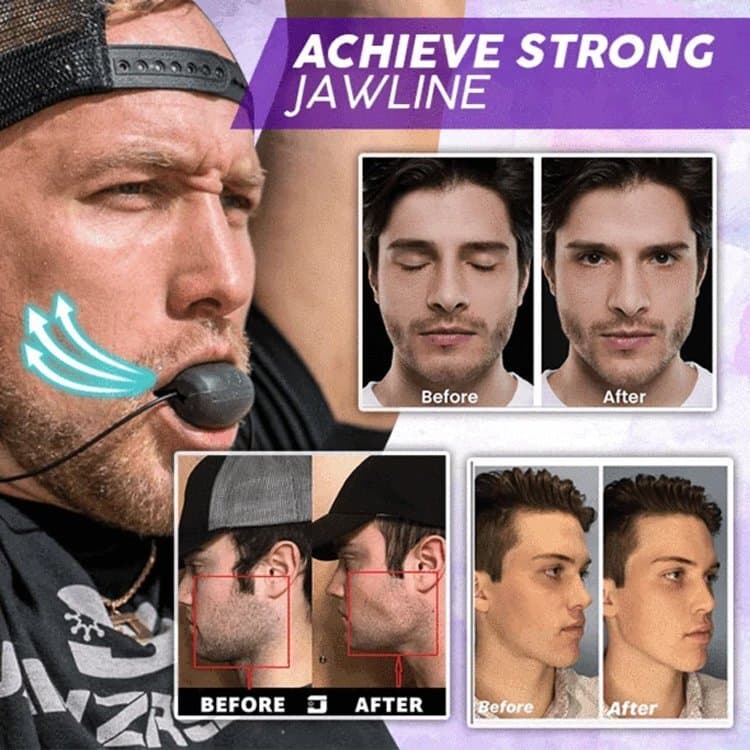 【Treinador de Mandíbula】Implante De Silicona Para Mandible/Silicone/Fortalecimento/Exercício