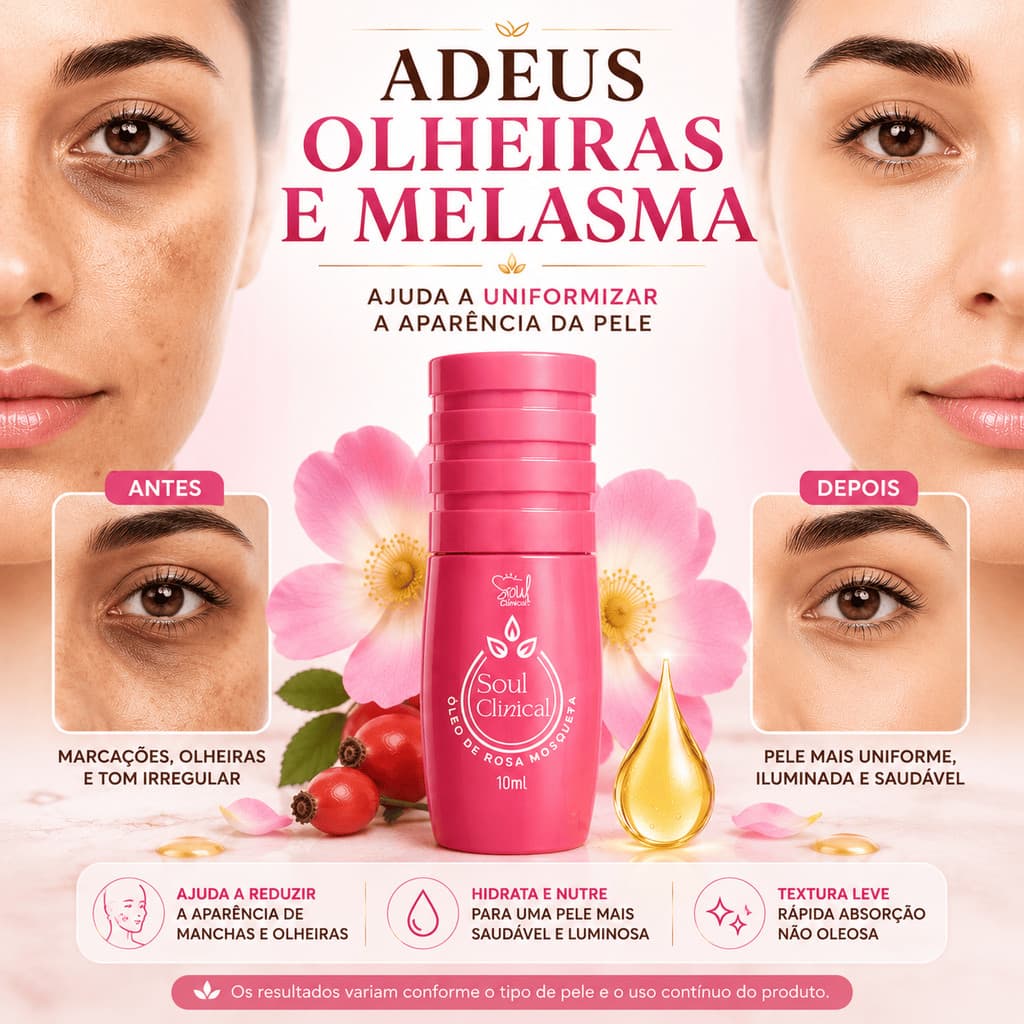 Óleo de Rosa Mosqueta 10 ml clareador para manchas e cicatrizes
