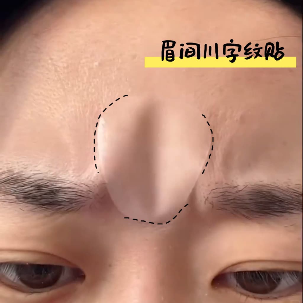 Chuanzi padrão adesivos dormir dedicado sobrancelha testa adesivos levantamento Facial adesivos invisíveis firme endurec