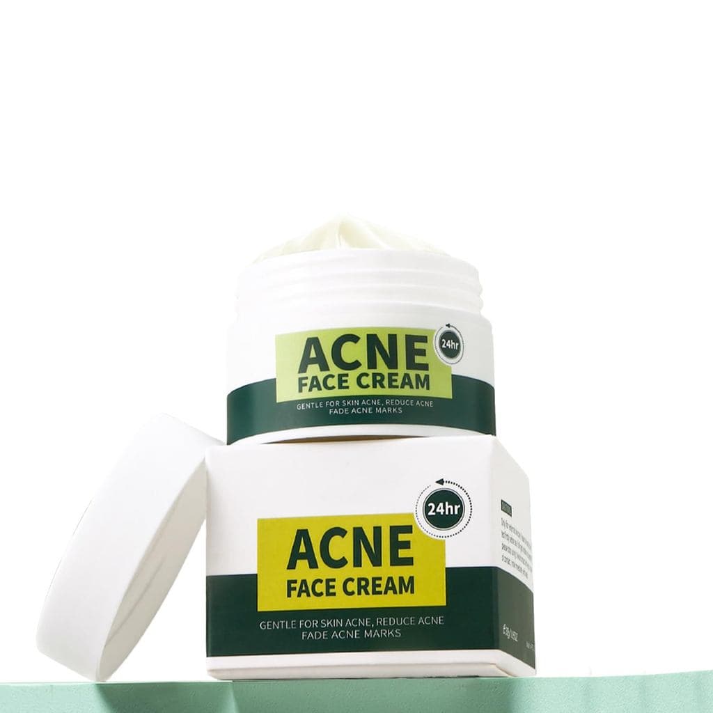 Creme para Acne Facial - Creme para Espinhas com Óleo de Tea Tree e Ácido Salicílico, Fórmula de Ação Rápida para Pele O