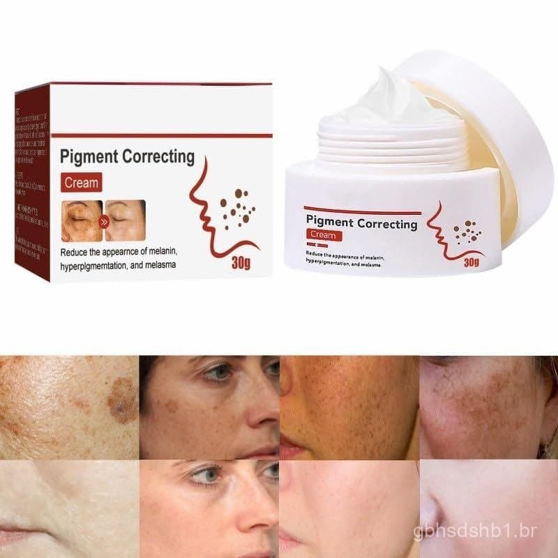 1/2/3 tubos de creme para manchas faciais, 30ml de creme para manchas na pele, creme para manchas escuras no rosto (1 tu