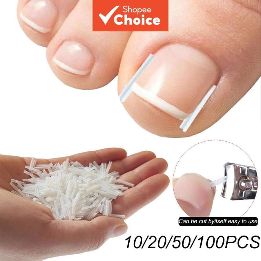 Kit-10/20/50/100Pcs Adesivo Elástico de Tratamento para Unhas Encravadas, Grampo de Alisamento, Braçadeira, Ferramenta