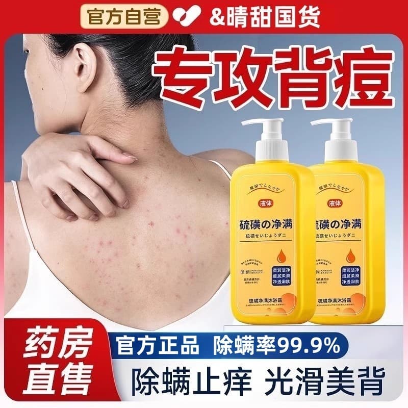 Gel de banho de enxofre antigo Shanghai, remove ácaros da pele, pontos vermelhos, coceira na pele, remove coceira, ofici