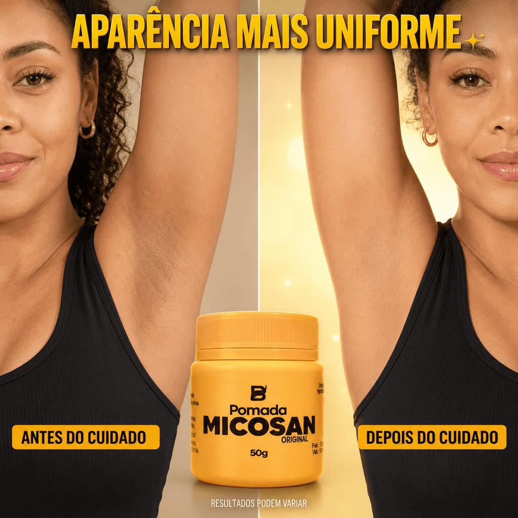 Pomada Micosan Original 50g para Frieiras Micoses Fungos na Pele e Clareamento.