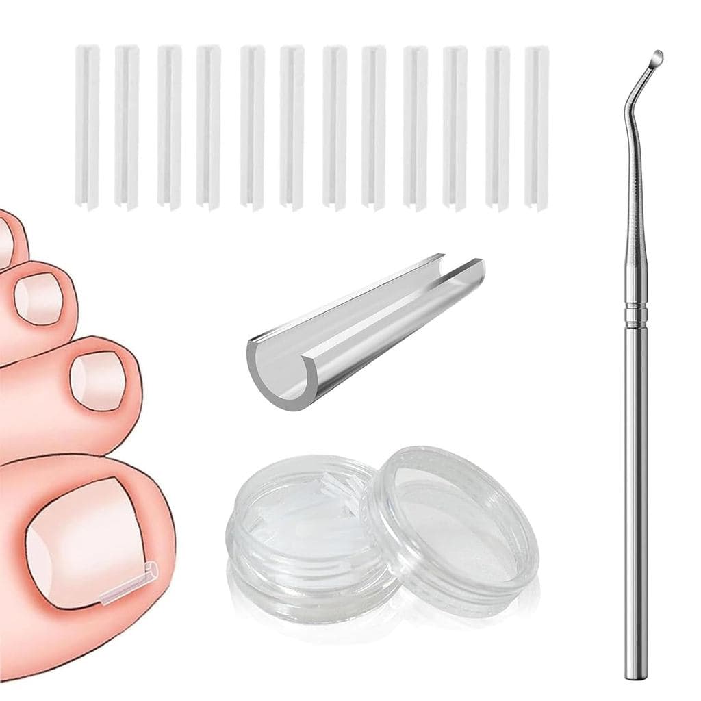Conjunto de 50 Peças para Correção de Unhas Encravadas, Kit de Tiras e Suportes para Correção de Unhas, Almofadas de Cor