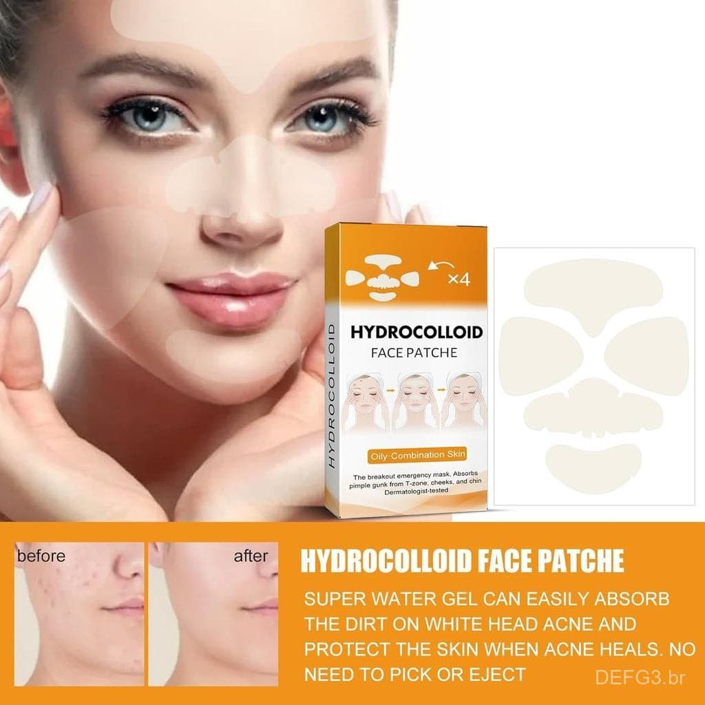 20 adesivos hidrocoloides para acne, adequados para cobrir acne em todo o rosto, com boa absorção, tratando eficazmente