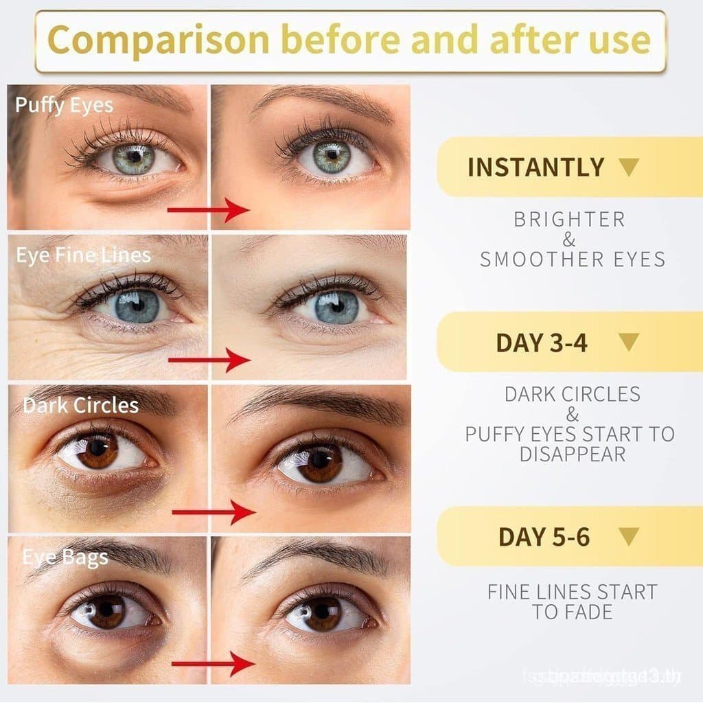 Patches para Olhos de Ouro 24K - 60 peças, adequados para olhos inchados, olheiras, bolsas nos olhos e rugas, contém col