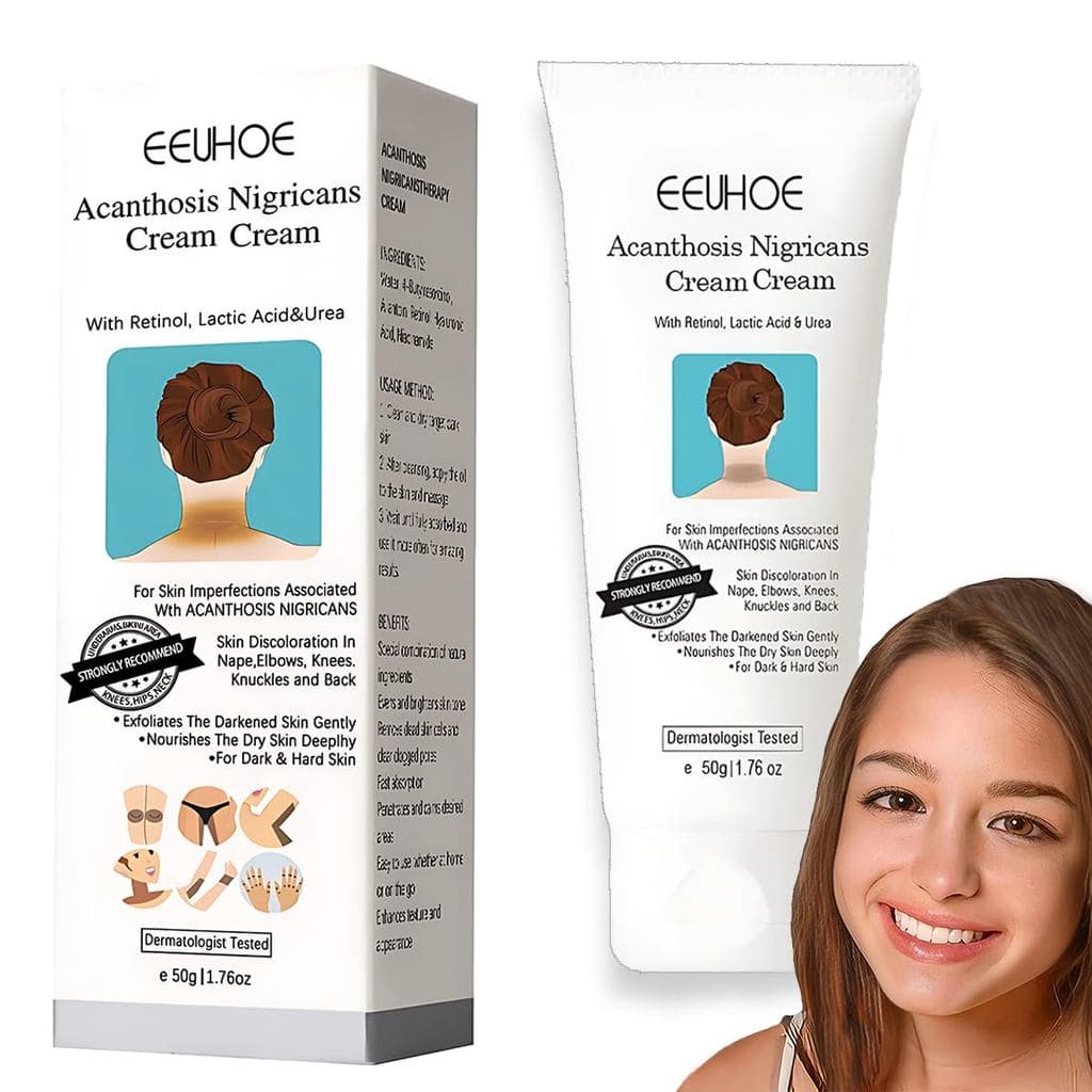 Removedor de manchas corporais, creme corretor de manchas - para axilas, pescoço, virilha, joelhos, cotovelos, áreas ínt