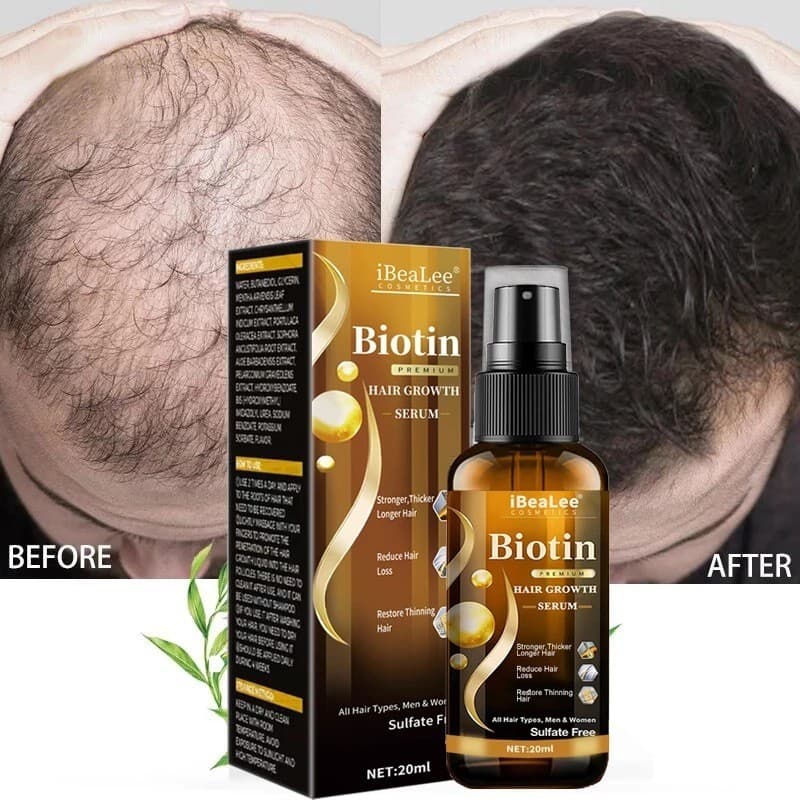 Solução de cuidados capilares IBeaLee para fortalecer a nutrição do cabelo, evita queda, hidratante, raízes do cabelo, m