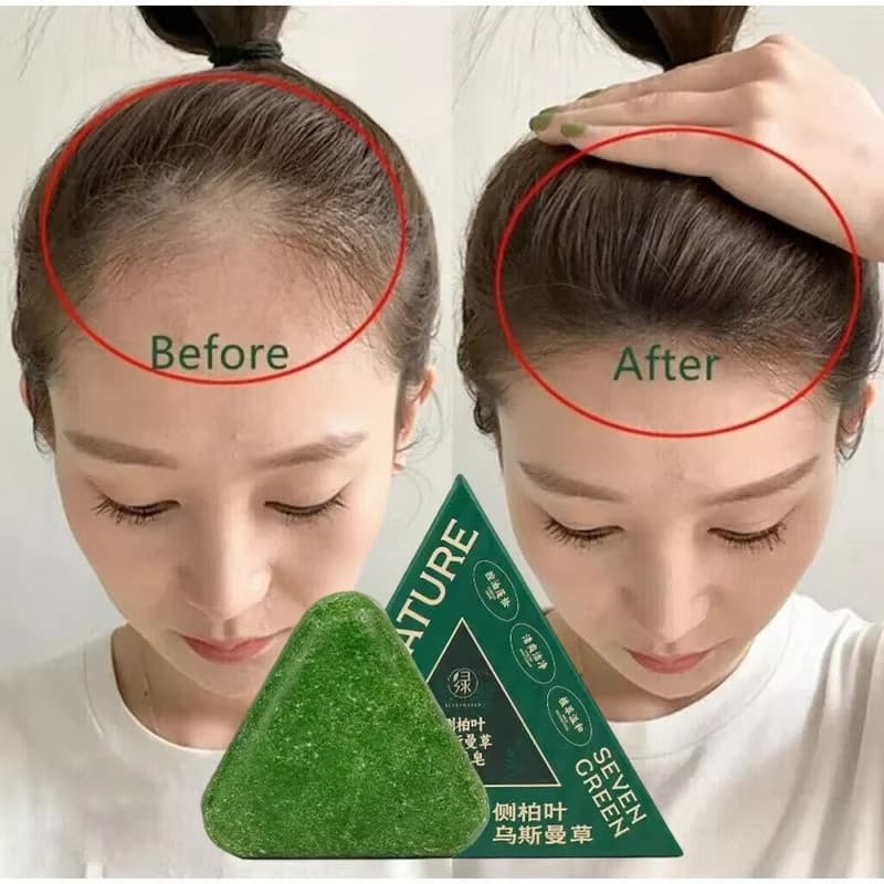5 Pçs Portátil Thuja Folha Shampoo Sabão Unisex Profissional Natural Cabelo Ervas Bonito Reduz Ferramentas De Perda De