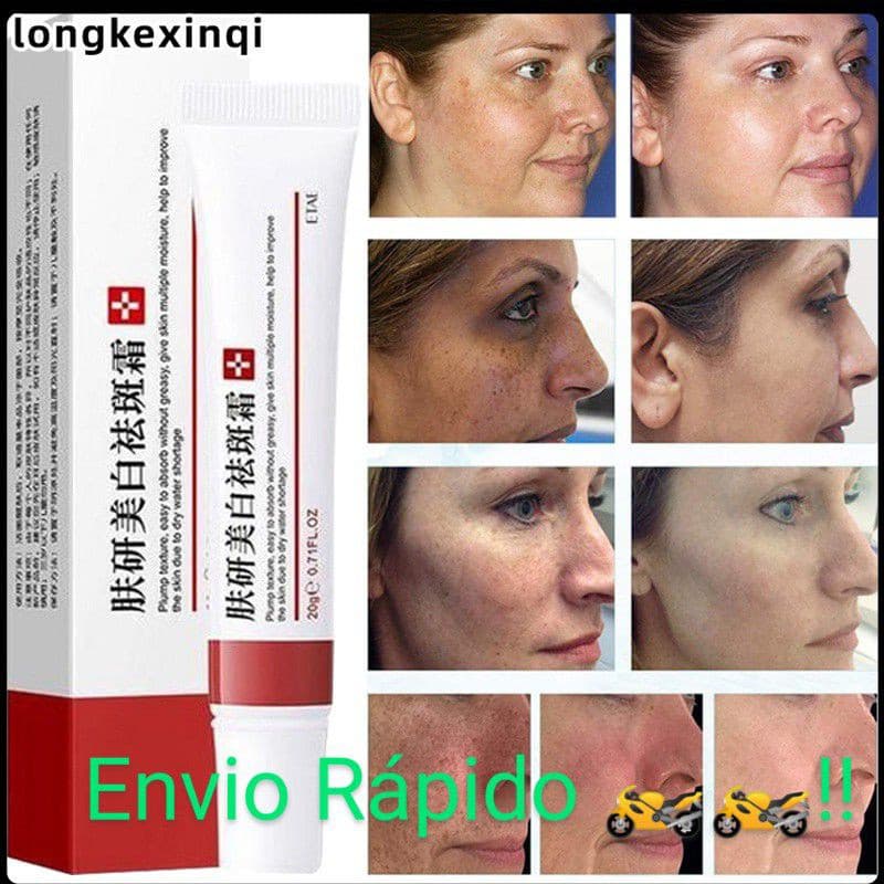 Creme Para Remoção E Clareamento De Sardas , Fórmula Secreta Oriental , Purifica Suaviza A Pele , Suave Sedoso