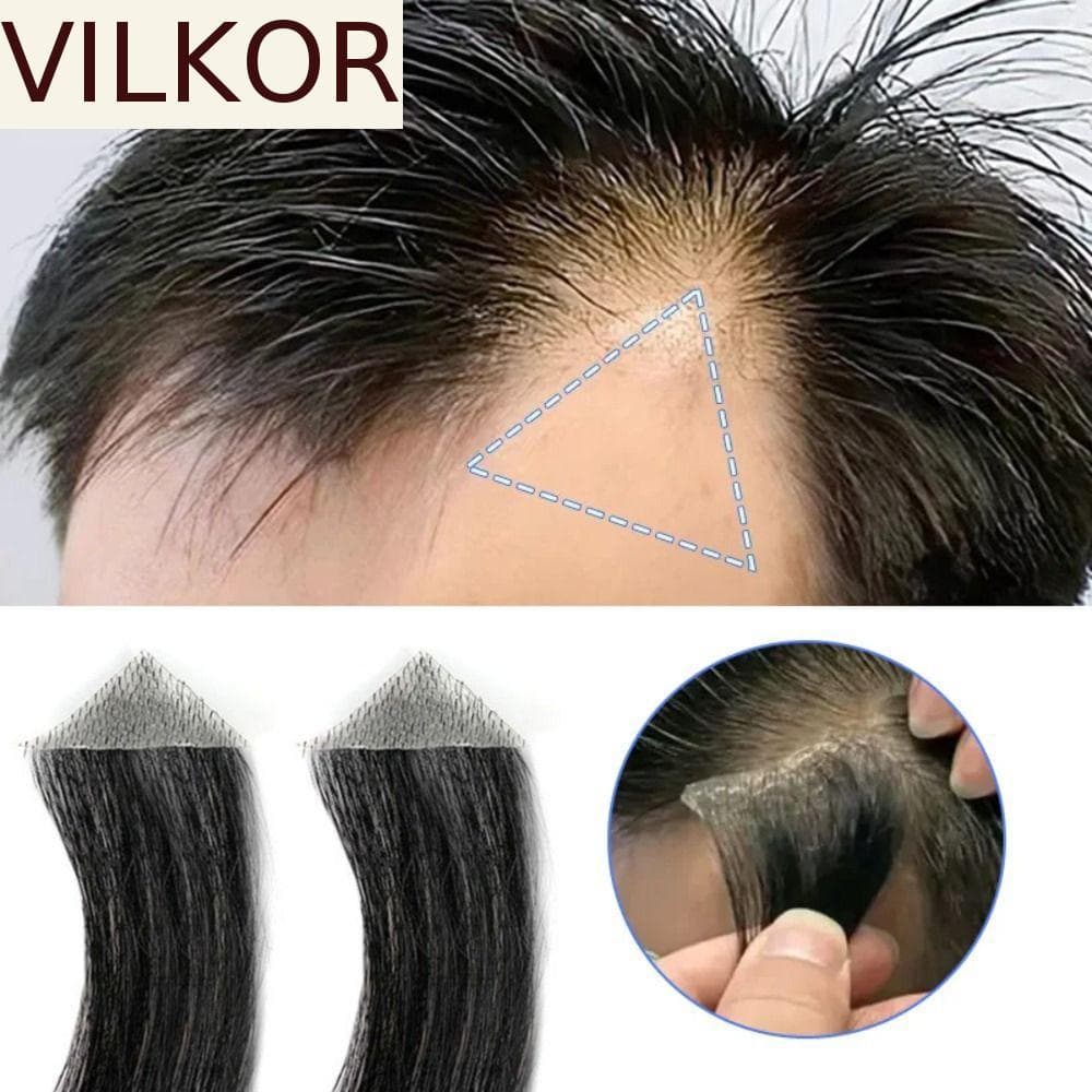 VILKOR 100 % Peruca De Cabelo Humano , Costeletas , Pele Ultrafina , Adesivo De Testa PU , Invisível