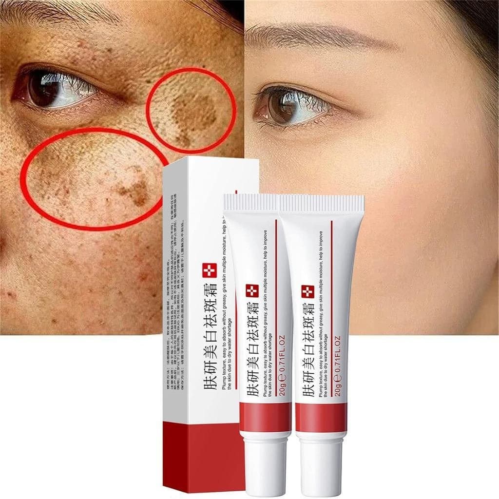 Pacote com 2 Peças: Remove Sardas, Cicatrizes de Acne, Manchas Faciais, Acalma, Hidrata, Remove Cloasma Facial, Manchas