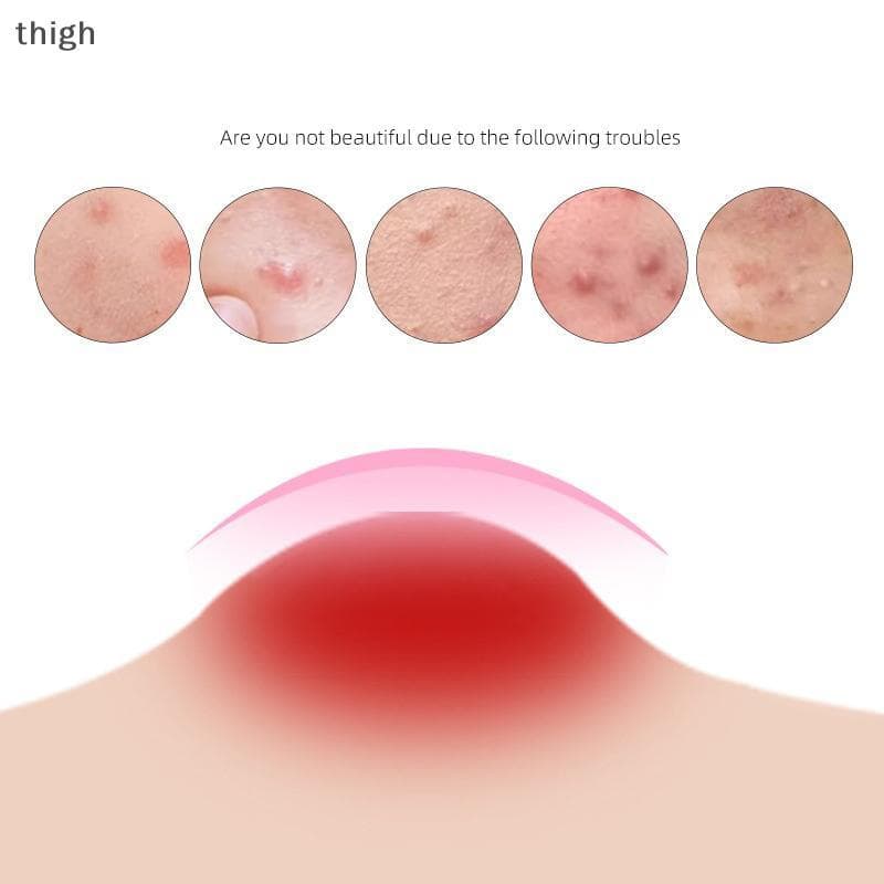 [thigh] Cor Cartoon Acne Patch Cuidados Com A Pele Stier Corretivo Facial Spot Beauty Makeup Tool