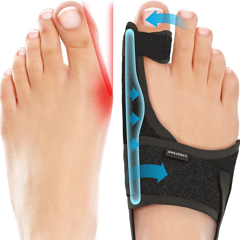 Sério grande pé polegar valgus toe valgus Corrector grande pé osso valgus toe divisor fivela interna pode usar sapatos