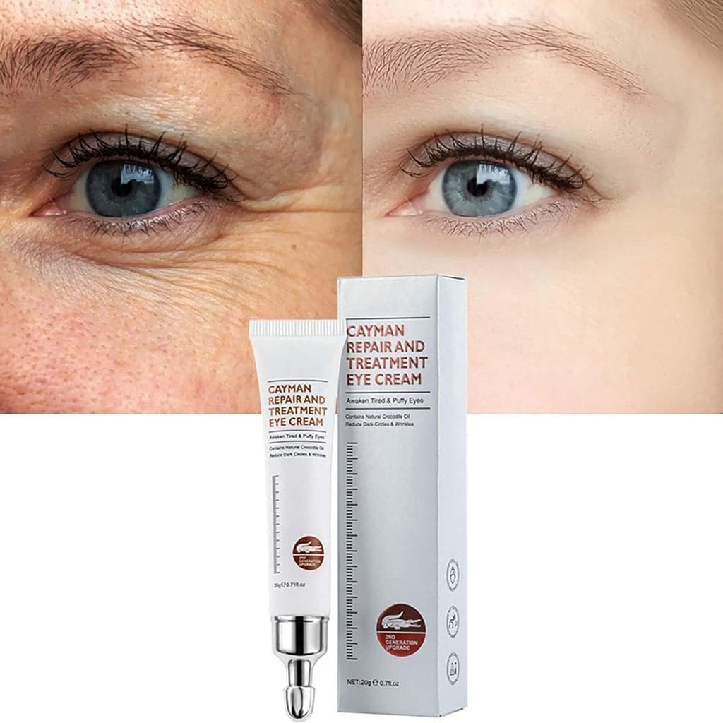 Creme Mágico para os Olhos, Remove Instantaneamente Bolsas sob os Olhos, Rugas, Inchaço, Olheiras e Linhas Finas, Creme