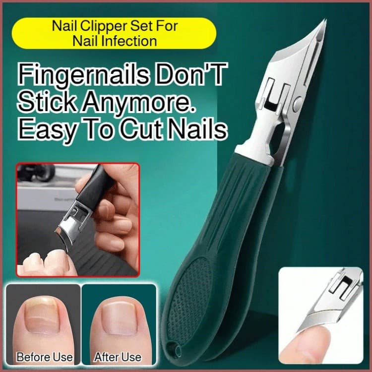【Especial para Unhas Encravadas】[Cuidados com Unhas] Conjunto de cortadores de unhas domésticos, cortadores de unhas esp
