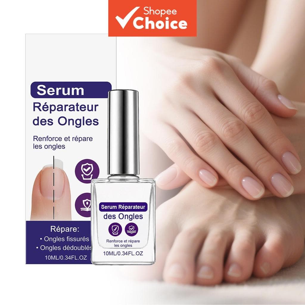 Unhas 10ml - Tratamento, de Unhas & Óleo para Cutículas, Óleo de Gengibre, Repara Unhas Quebradiças para