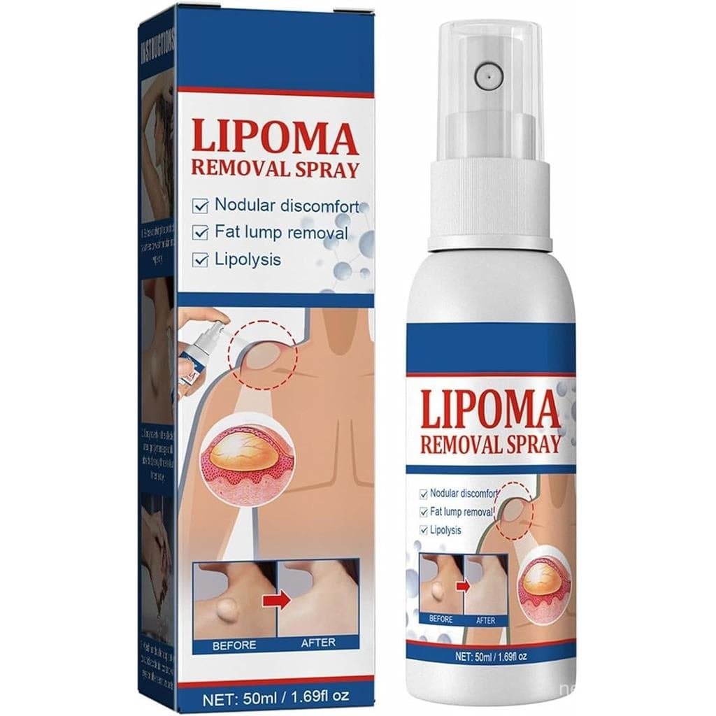 Spray para Remoção de Lipomas, Redução de Lipomas, Spray Modelador Corporal Anticelulite para Homens e Mulheres, 50ml