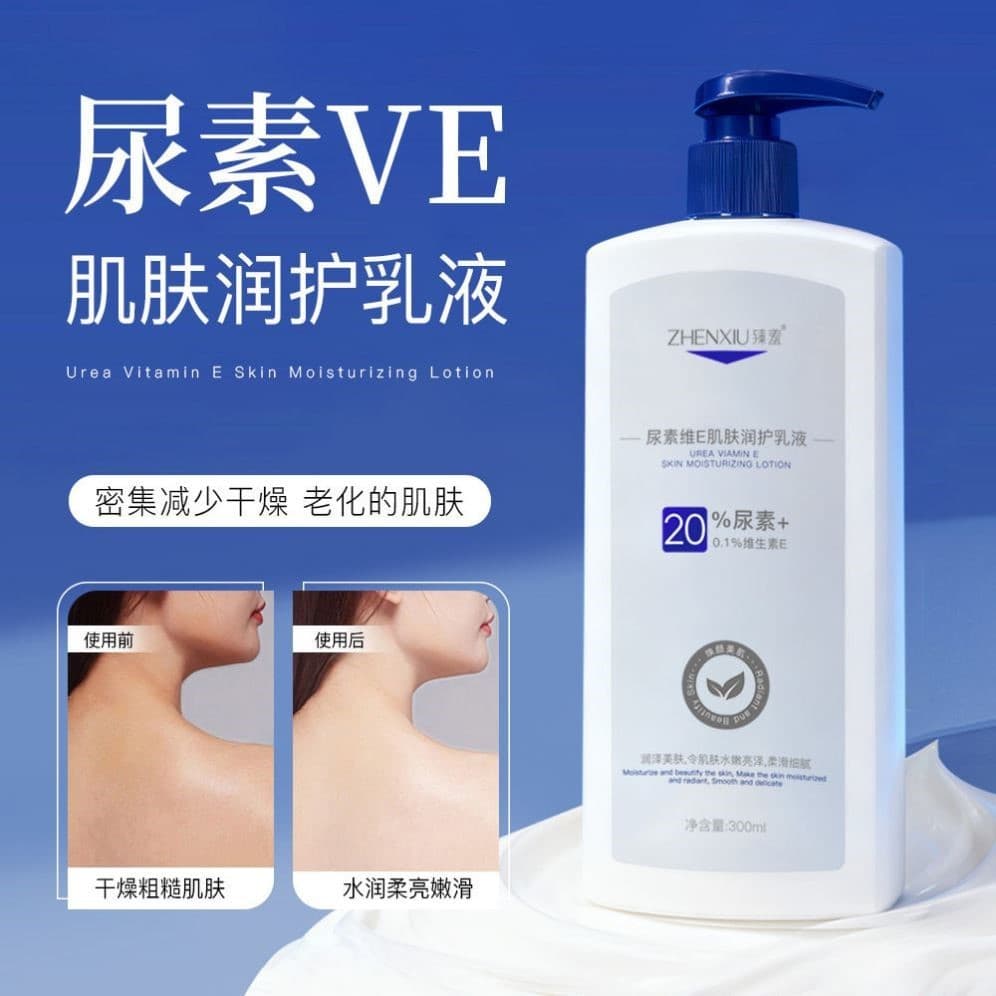 Vitamina e creme de ureia médica crianças loção corporal hidratante hidratante pele feminina seca ureia loção corporal m
