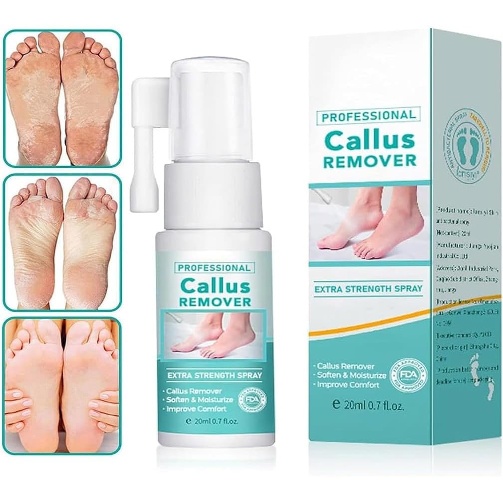 Removedor de Calos Profissional em Spray de Força Extra, Removedor de Calos para os Pés em Spray de Força Extra, Spray E