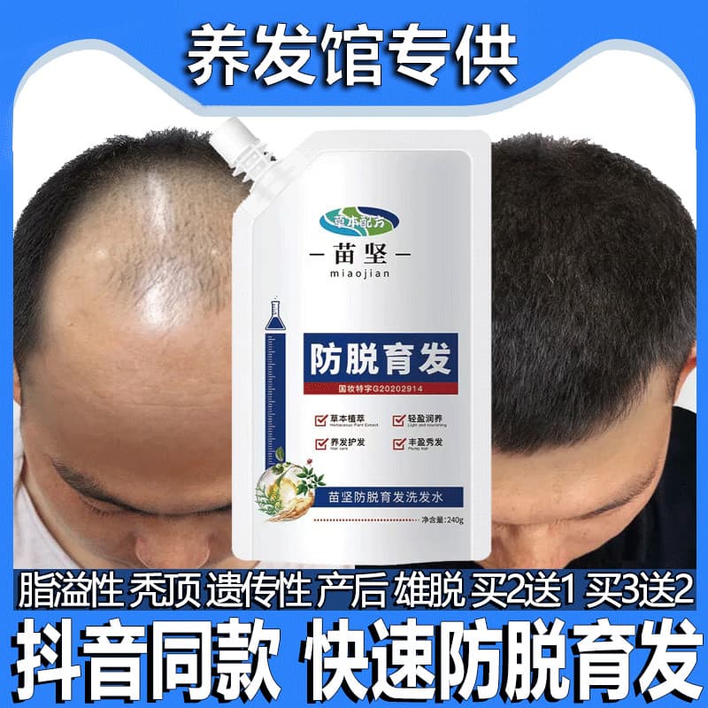 Medicina chinesa Anti-perda de cabelo Shampoo perda de cabelo aumentar a densidade do cabelo calvície Overflow pós-parto