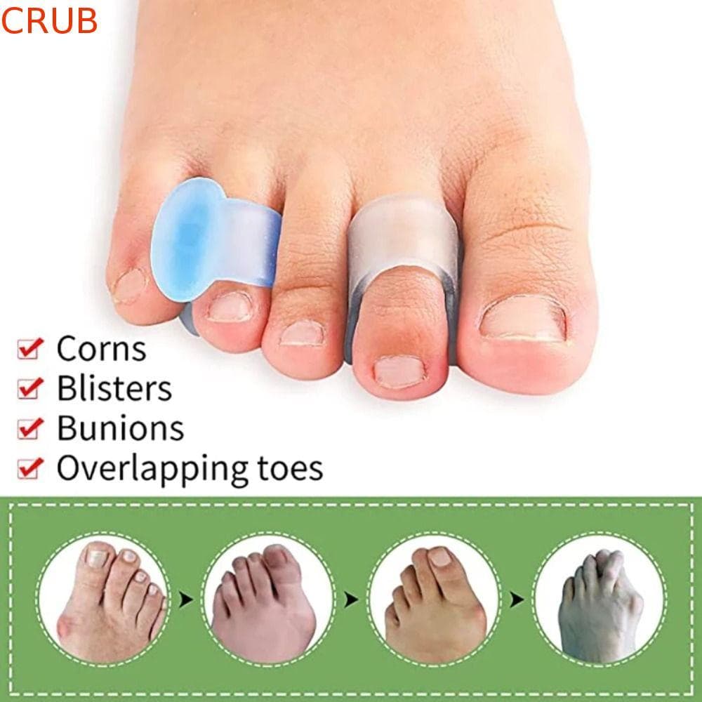 Produtos Ortopédicos Do Dedo Pé  Para Pedicure Corretor De Joanete Espaçador Cuidados Com Os Pés Espalhador Separado