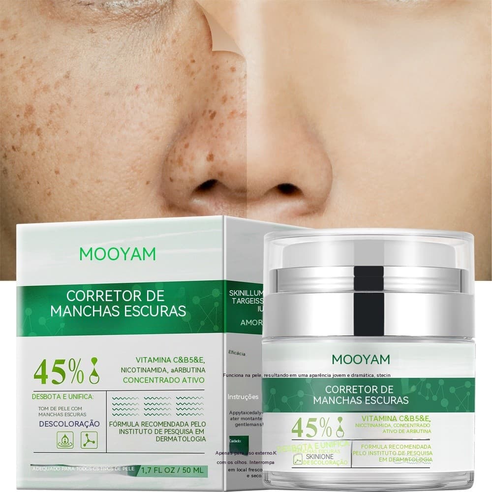 Creme para remoção de sardas, reduz a melanina e as manchas na pele, ilumina o tom da pele, uniformiza o tom da pele, cr