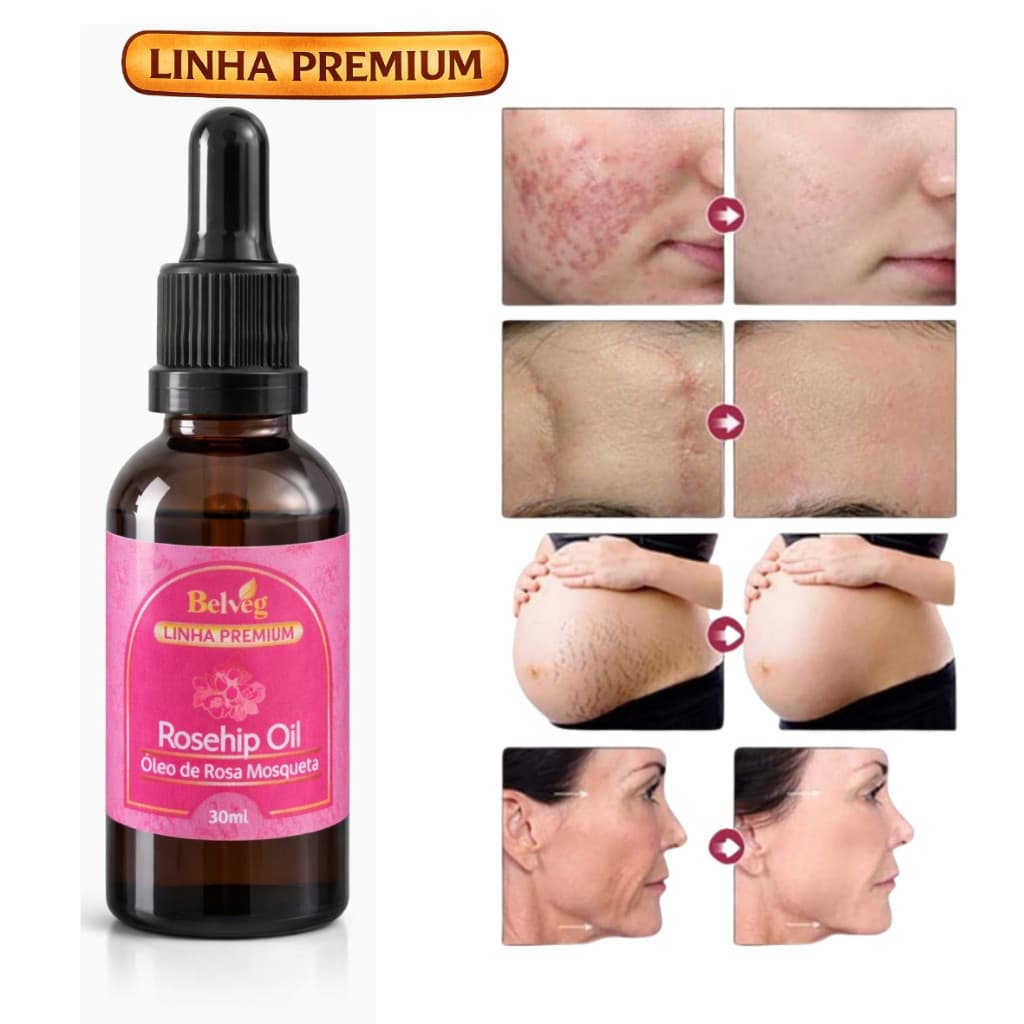 Óleo Rosa Mosqueta 100% Puro Natural 30ml Vegetal