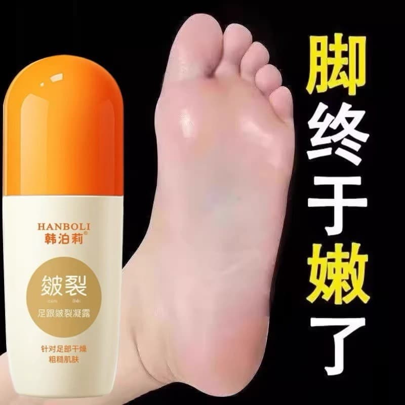 Han Polly Calcanhar Rachado Gel Hidratante Calcanhar Seco Rachado Peeling Creme Reparador Anticongelante Roll-On Creme p