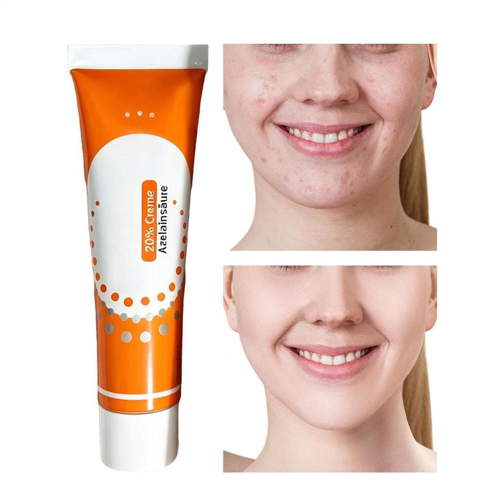 Creme Hidratante 30g Calmante Pomada Facial Natural Reparação Para Acalmar Homens Mulheres Todos Os Tipos De Pele Seca S